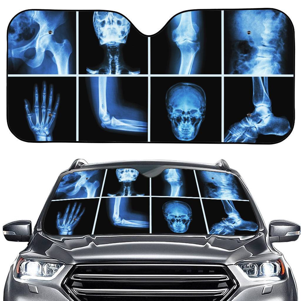 X-Ray Film Radiology Print Car Windshield Sun Shade